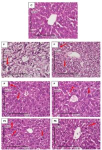 FIGURE 1: Comparison of microscopic features of lactating hepatocyte degeneration of mice (Mus musculus) during lactation with H.E staining, X 400.