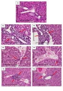 FIGURE 3: Comparison of microscopic images of inflammation cell in the liver of lactation mice  (Mus musculus) with H.E staining, X 400.